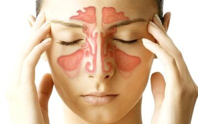 Sinusitis a Very Common Condition