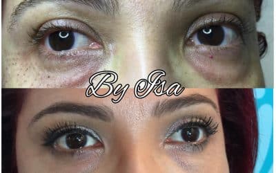 The Affordable No-Scalpel Lift: Avatar Lifting Therapy for Brighter Eyes and Firmer Skin (With Minimal Downtime)